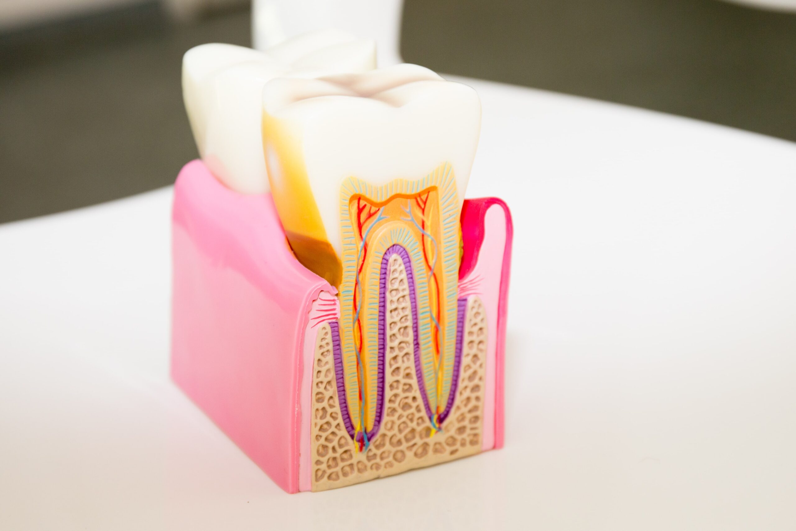 Root Canal Treatment Cost Australia: How Much Should You Expect to Pay?