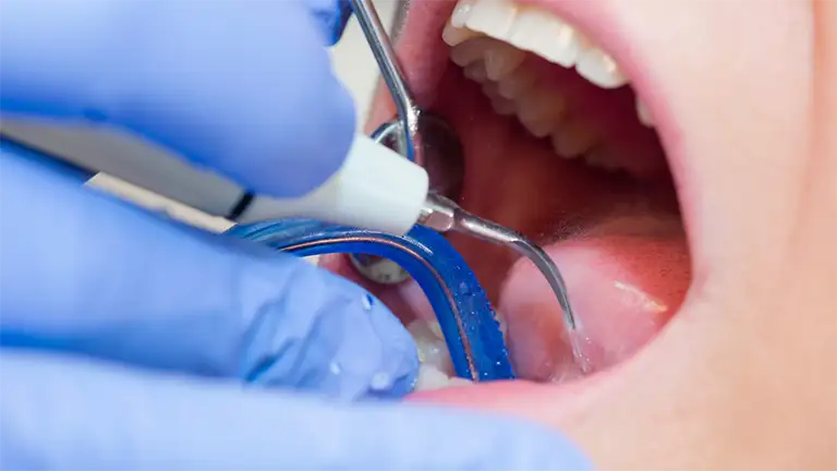 Emergency dentist in Clayton