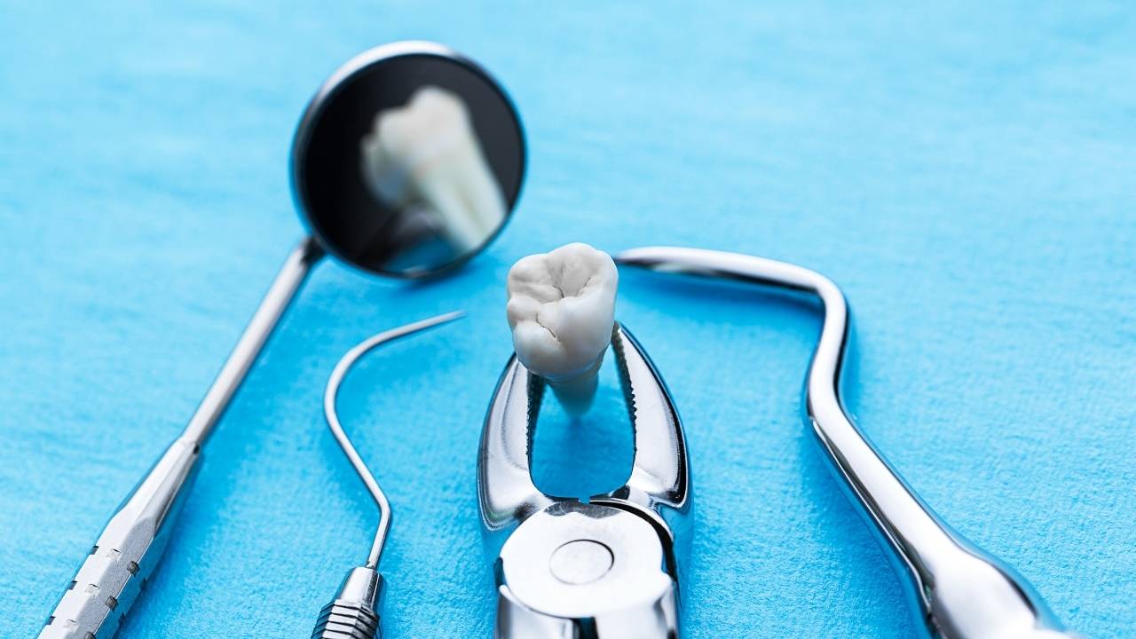 Wisdom tooth extraction treatment in dental clinic