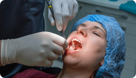 Periodontal Treatments